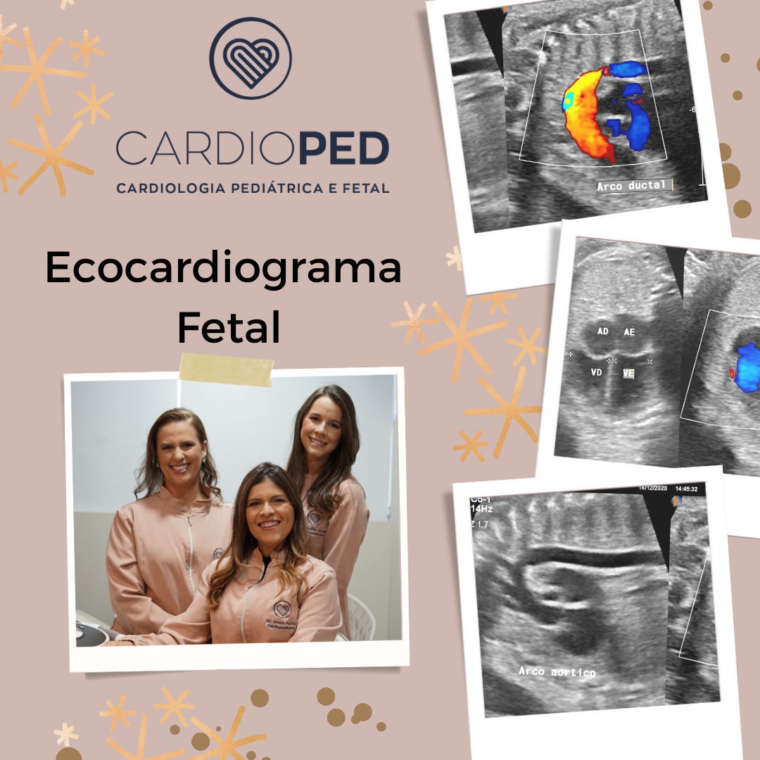 O Ecocardiograma Fetal CardioPED Recife